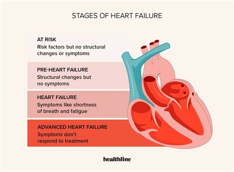 Congestive Heart Failure: Symptoms, Stages & Treatment.